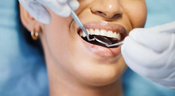 Best Pediatric Emergency Dentist in Riverdale, NJ