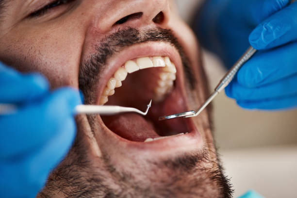 Best Emergency Dental Care for Trauma or Injury in Riverdale, NJ